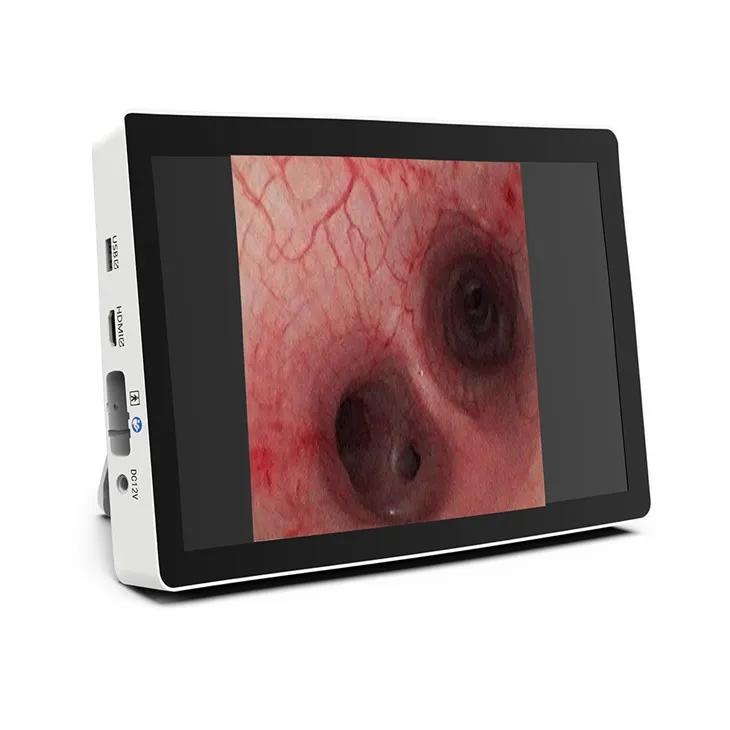 Portable Image Processor With Build In
